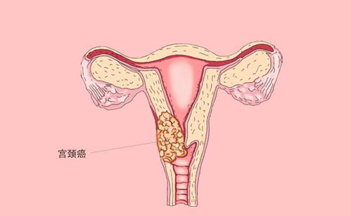 月经前一天做体检吗 姨妈前一天去体检 月经前一天做体检吗 姨妈前一天去体检