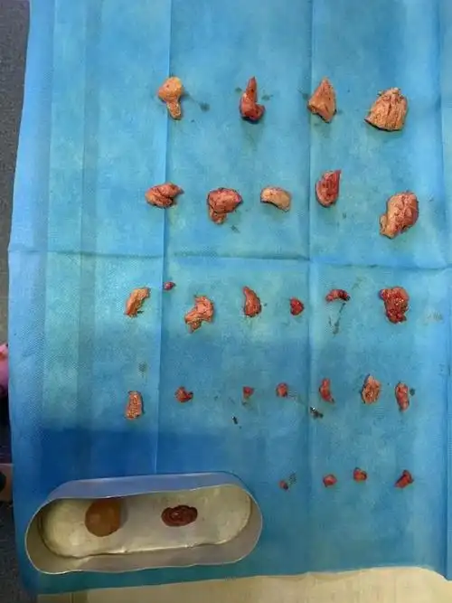 痛经能不能吃田七治痛经 痛经能不能吃田七治痛经