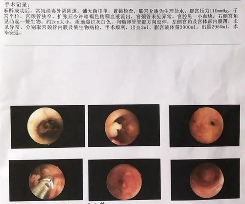 阴道炎有哪几种症状 阴道炎有哪几种症状