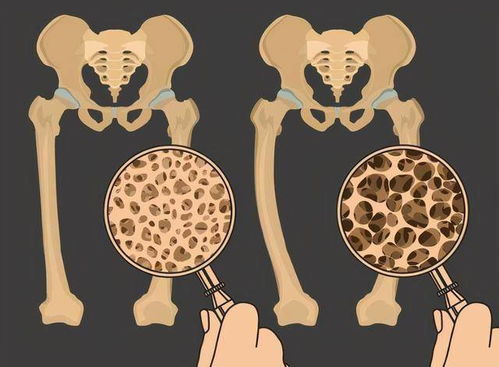 怀孕初期会有痛经的感觉吗 怀孕初期会有痛经的感觉吗