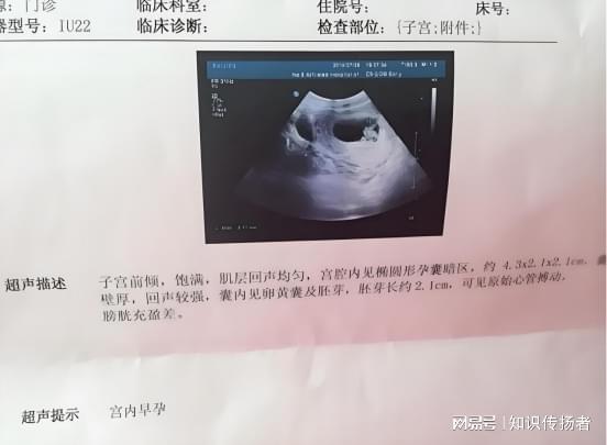 不痛经的人能喝凉的吗 不痛经的人能喝凉的吗