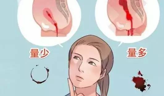月经返潮原因(月经返潮量越来越多) 月经返潮原因(月经返潮量越来越多)