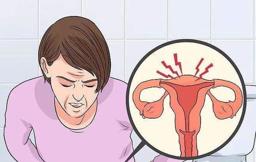 女人白带过多是什么回事? 女人白带过多是什么回事?