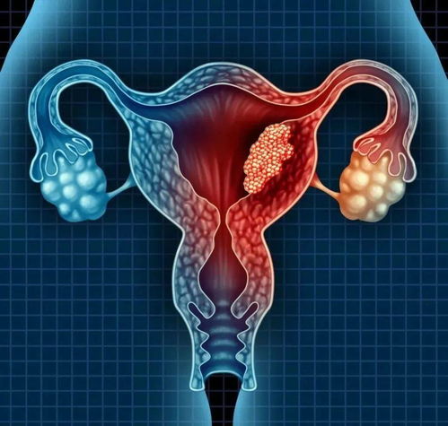 女人月经量少是什么原因引起的? 应该怎么调理? 女人月经量少是什么原因引起的? 应该怎么调理?