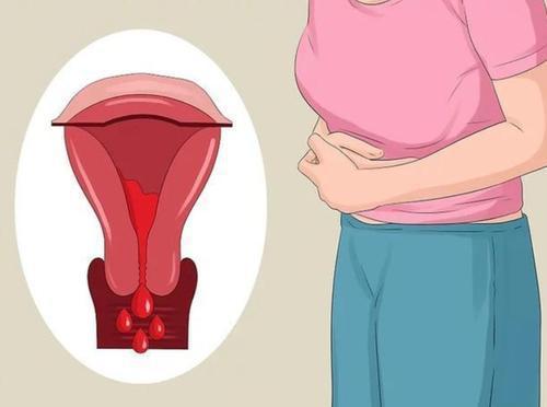 诊断子宫肌瘤要借助哪些检查 诊断子宫肌瘤要借助哪些检查