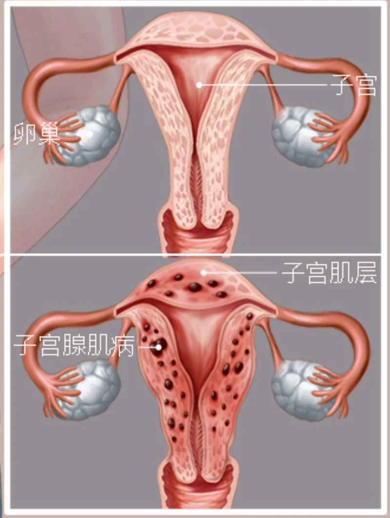 痛经的人早孕会痛经么嘛 痛经的人早孕会痛经么嘛
