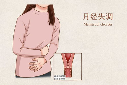 月经后头痛什么原因 月经后头痛什么原因躺着不痛 月经后头痛什么原因 月经后头痛什么原因躺着不痛