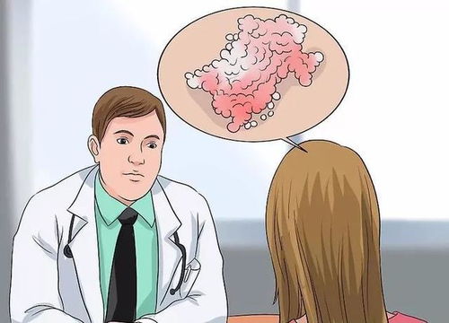 月经不调而且量少怎么办 月经不调而且量少怎么办