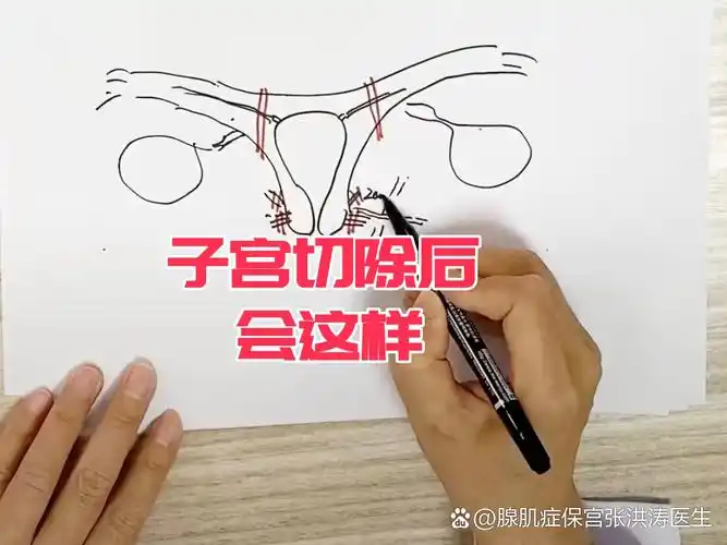 青春期痛经能不能吃药 青春期痛经能不能吃药