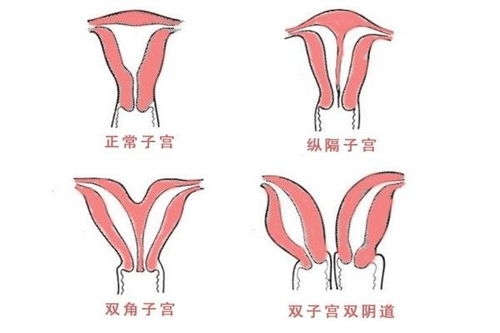 预防痛经的食疗方法有哪些? 预防痛经的食疗方法有哪些?