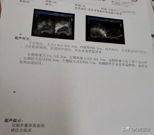 女性气血不足有哪些症状?应该怎么调理? 女性气血不足有哪些症状?应该怎么调理?