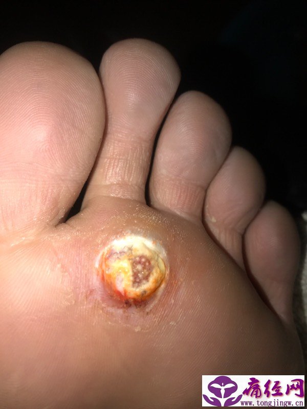 红糖姜糖水对痛经有用吗 红糖姜糖水对痛经有用吗