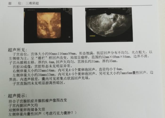 痛经睡前喝点啥 痛经睡前喝什么 痛经睡前喝点啥 痛经睡前喝什么