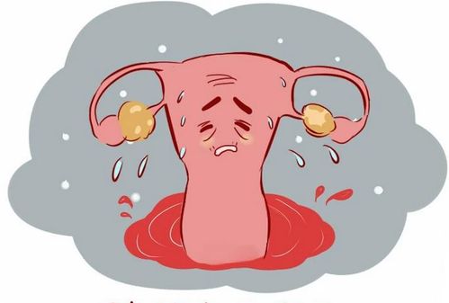 做过流产后月经很痛 流产后来月经痛经 做过流产后月经很痛 流产后来月经痛经