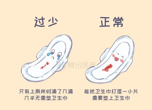 用针灸止痛经需要过程吗 用针灸止痛经需要过程吗