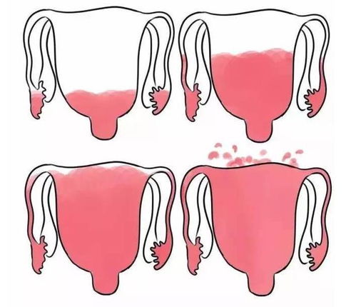 合理性生活可预防阴道炎 阴道炎的护理有哪些措施 合理性生活可预防阴道炎 阴道炎的护理有哪些措施