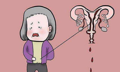 痛经你知道该怎么避免吗 痛经你知道该怎么避免吗