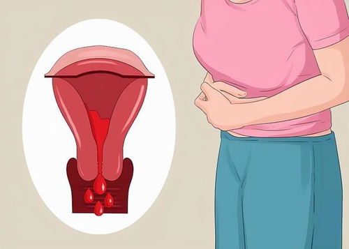 女孩可以吃痛经颗粒 痛经可以吃痛经丸吗 女孩可以吃痛经颗粒 痛经可以吃痛经丸吗