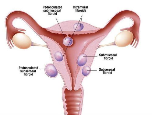 平常大姨妈痛经的人怀孕会痛经吗 平常大姨妈痛经的人怀孕会痛经吗