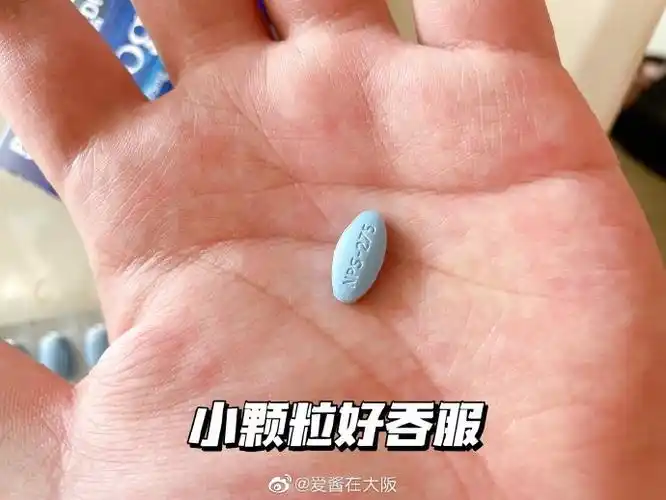 脂溢性脱发早期症状有哪些 早发现早治疗 脂溢性脱发早期症状有哪些 早发现早治疗