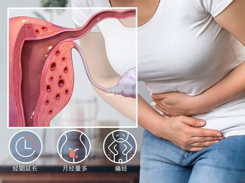 月经推迟量少与甲状腺 月经推迟量少与甲状腺