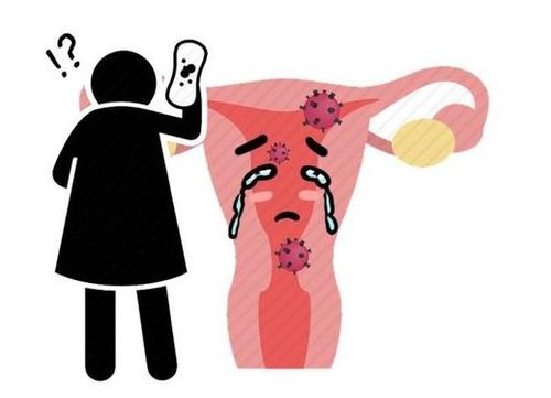 月经期间月经间断 姨妈间断性来是怎么了 月经期间月经间断 姨妈间断性来是怎么了