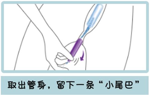 缓解女性痛经:安全用药指南,止痛片能否缓解痛经? 缓解女性痛经:安全用药指南,止痛片能否缓解痛经?