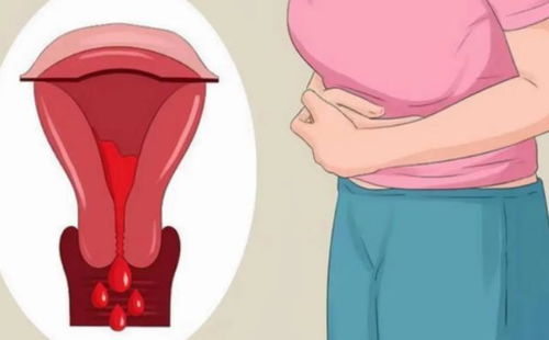 月经推迟3个月的原因 月经推迟3个月的原因