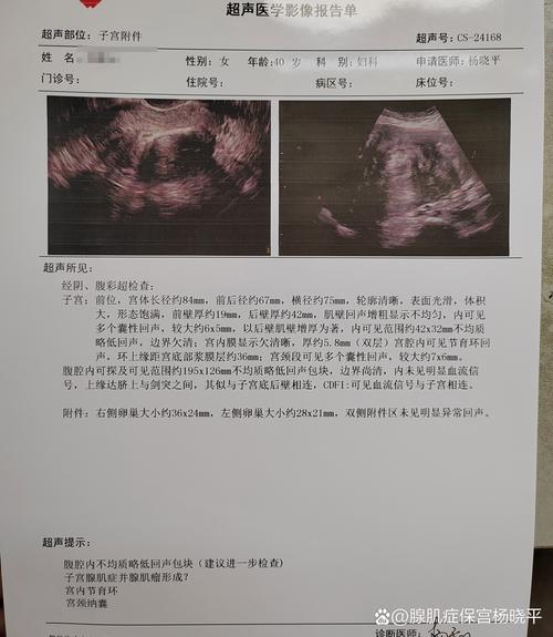 月经的血块是怎么形成的 月经的血块是怎么形成的