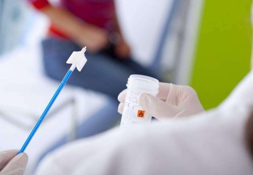 我国女性痛经占比多少 我国女性痛经占比多少