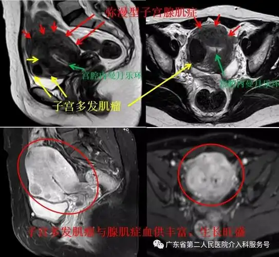 有白带是月经还是怀孕 有白带是月经还是怀孕