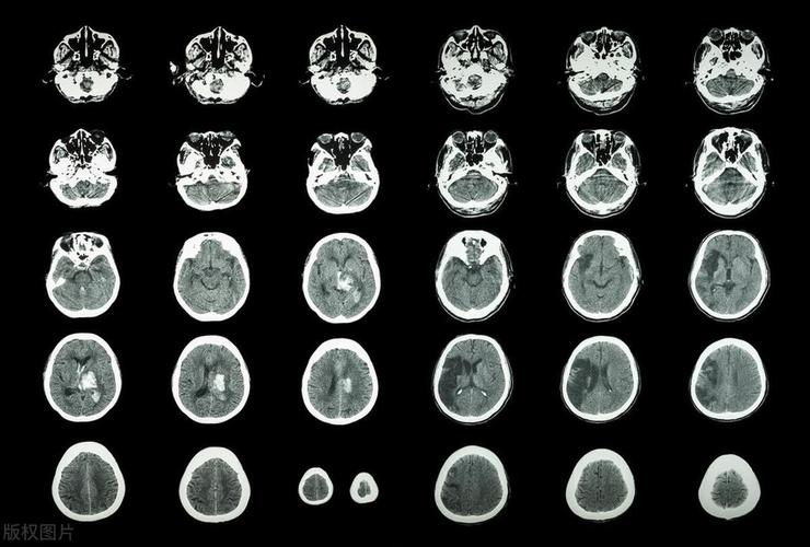 高房价还能撑多久 高房价后果 高房价还能撑多久 高房价后果
