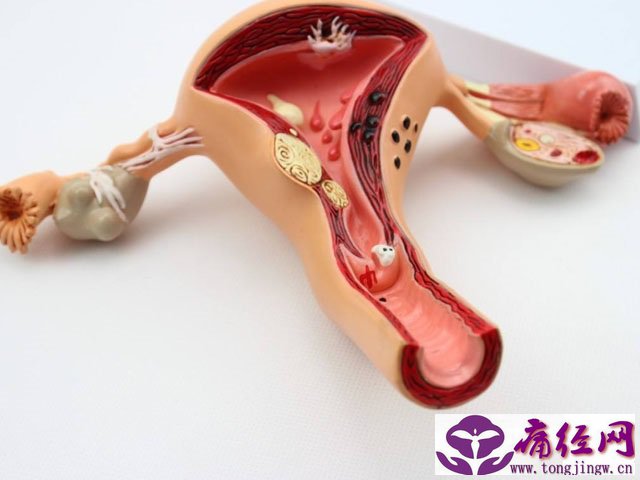 月经期间的忌讳吃什么 月经期间的忌讳吃什么