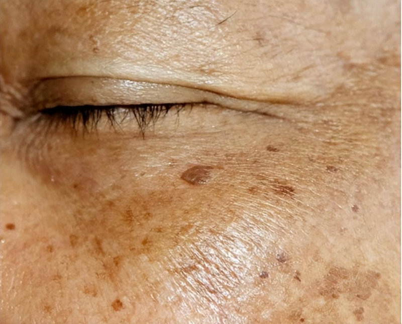 月经结束雌激素低 月经结束雌激素下降 月经结束雌激素低 月经结束雌激素下降