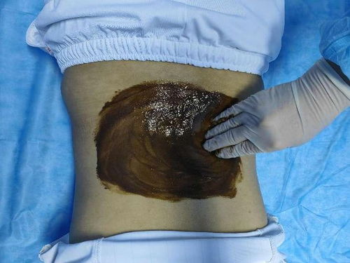 女性持续性痛经的原因是什么呢- 女性持续性痛经的原因是什么呢-