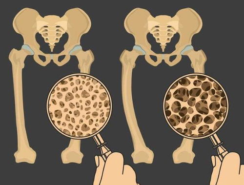 女性尿液和底裤有异味小心是尿道炎,教你3招来预防 女性尿液和底裤有异味小心是尿道炎,教你3招来预防