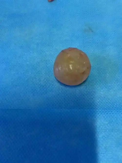 �¾���һ������ô����