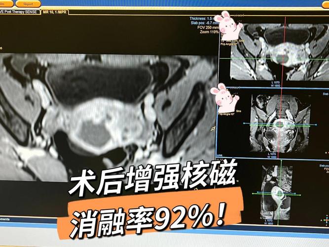 痛经期间吹头发会痛不痛 痛经期间吹头发会痛不痛