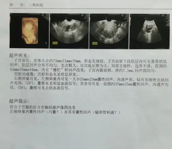 子宫内膜炎的原因包括哪几种 子宫内膜炎的原因包括哪几种