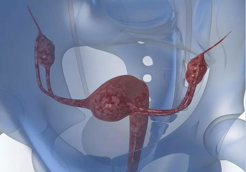 月经量少与卵巢有关吗 月经量少与卵巢有关吗