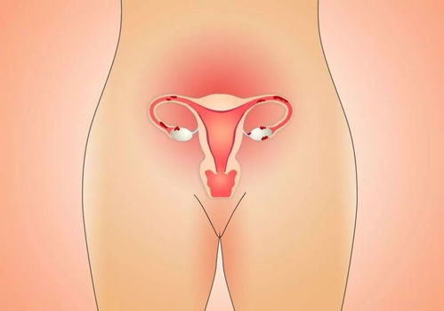 肾虚来月经_肾虚来月经是什么颜色 肾虚来月经_肾虚来月经是什么颜色