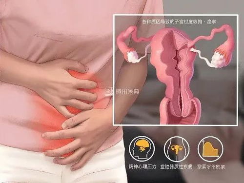 痛经肚子疼多长时间正常 痛经肚子疼多长时间正常