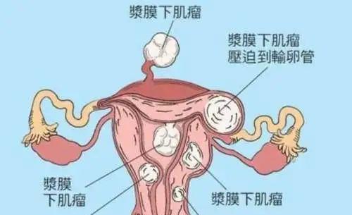 人参枸杞茶的功效与禁忌 人参枸杞茶的五大功效 人参枸杞茶的功效与禁忌 人参枸杞茶的五大功效