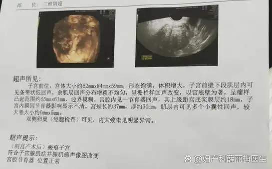 八一建军节手抄报 八一建军节手抄报第一名 八一建军节手抄报 八一建军节手抄报第一名