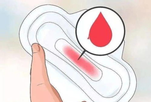 突然痛经刺痛怎么缓解 突然痛经刺痛怎么缓解