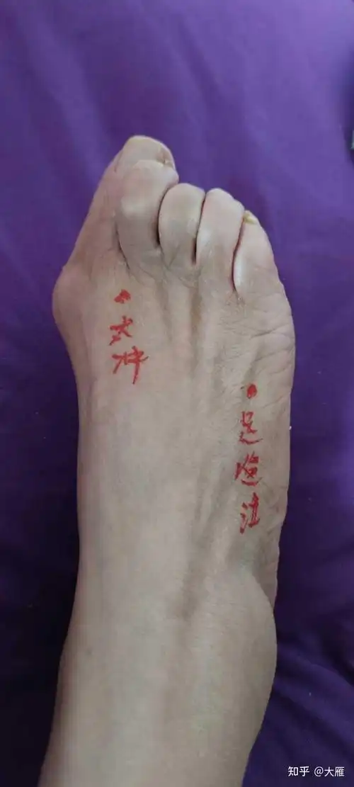 宫外孕自我诊断的依据是什么 宫外孕自我诊断的依据是什么