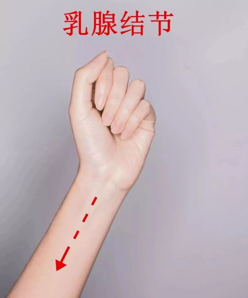 霉菌性阴道炎的种类包括哪几种 霉菌性阴道炎的种类包括哪几种