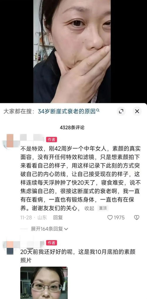 女性乳腺小叶增生治疗的几大误区 女性乳腺小叶增生治疗的几大误区