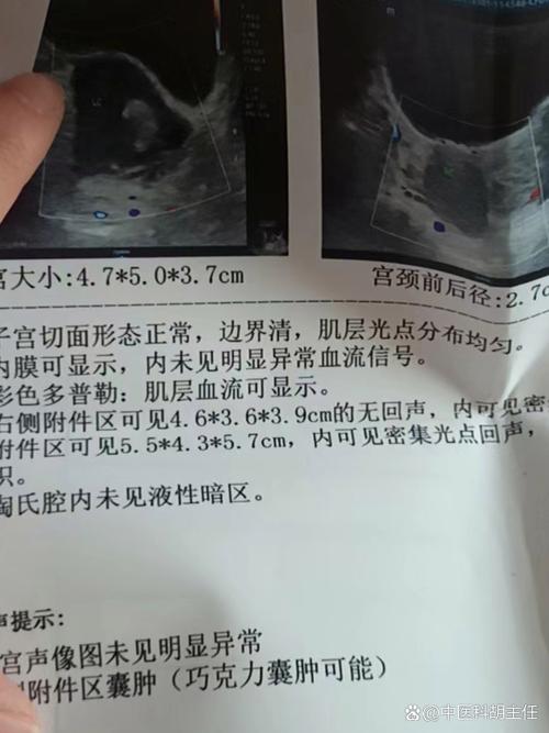 月经量少按什么穴位 月经量少按摩图 月经量少按什么穴位 月经量少按摩图