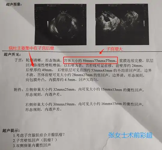 绨ѩ¾ָ 绨ѩ±־ָ